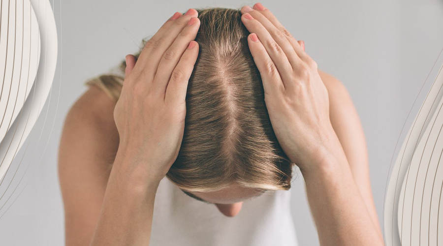 can extreme stress cause hair loss