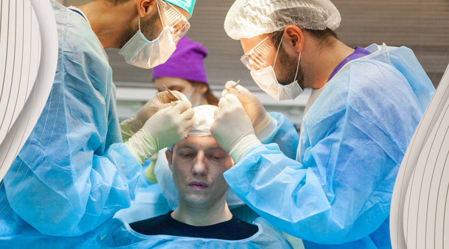 best hair transplant in the world