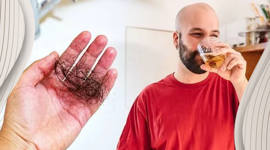 Alcohol and hair loss