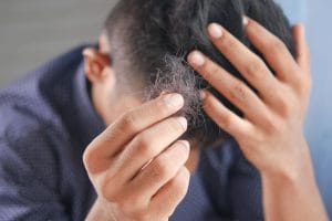 Can Stress Cause Hair Loss