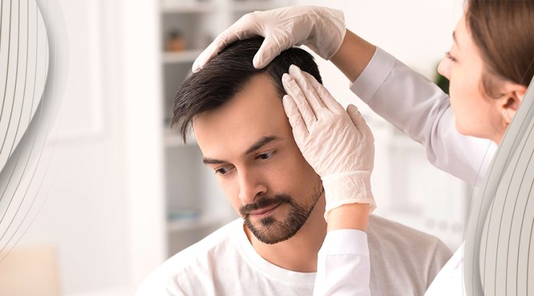 turkey hair transplant 360 Technique