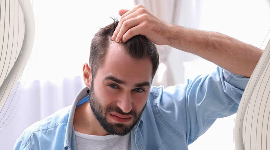 When to Get a Hair Transplant