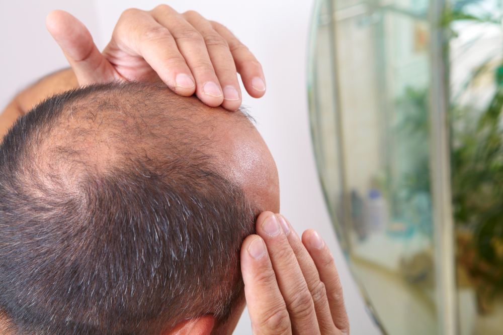 Why Hair Transplant May Fail