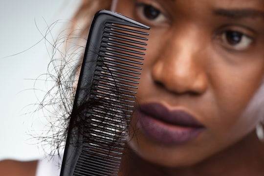 Worried individual examining a comb filled with fallen hair, symbolizing signs of hair loss and the need for medical diagnosis or treatment.