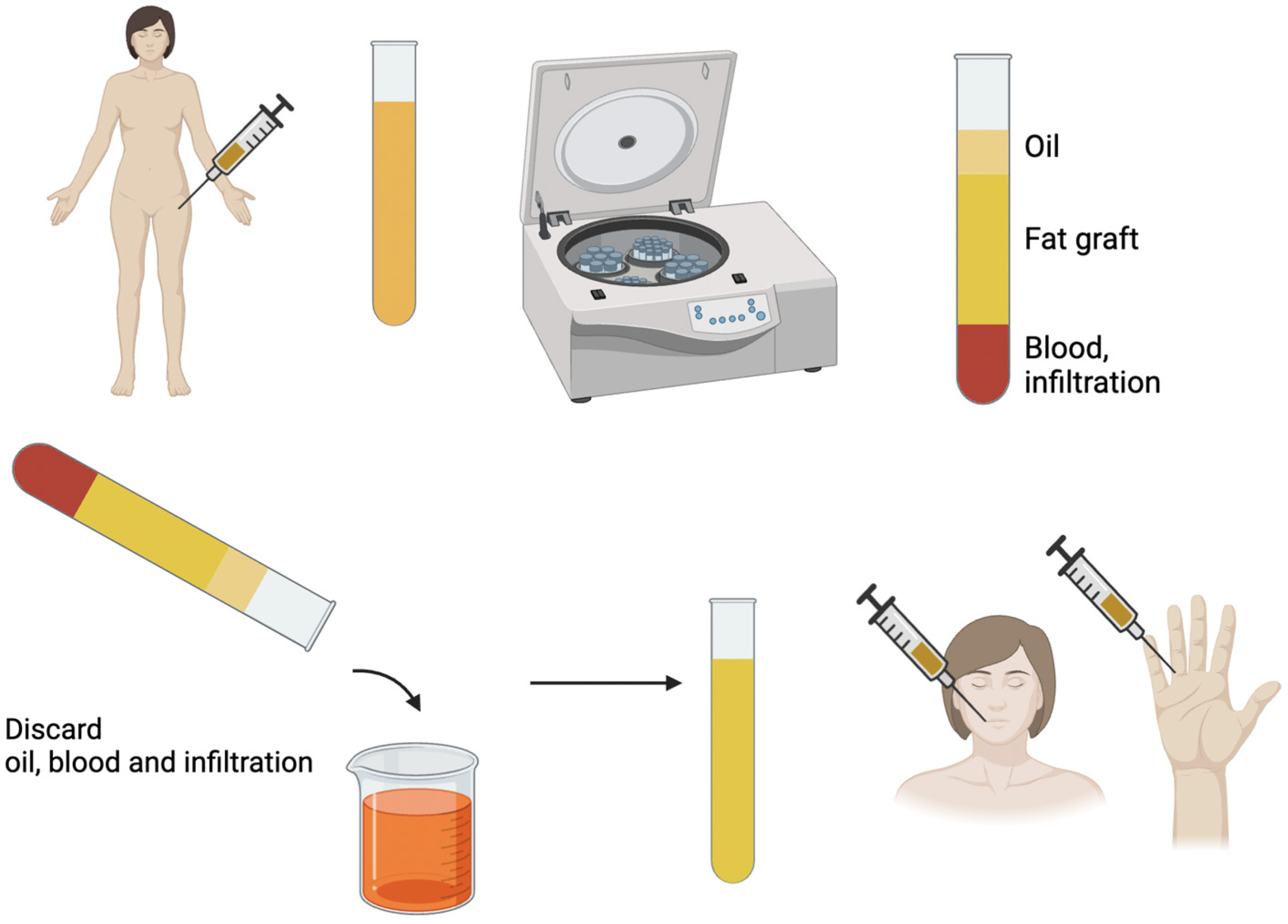 Fat Grafting Stem Cells