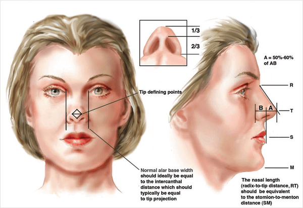 Rhinoplasty Surgery in turkey how is done