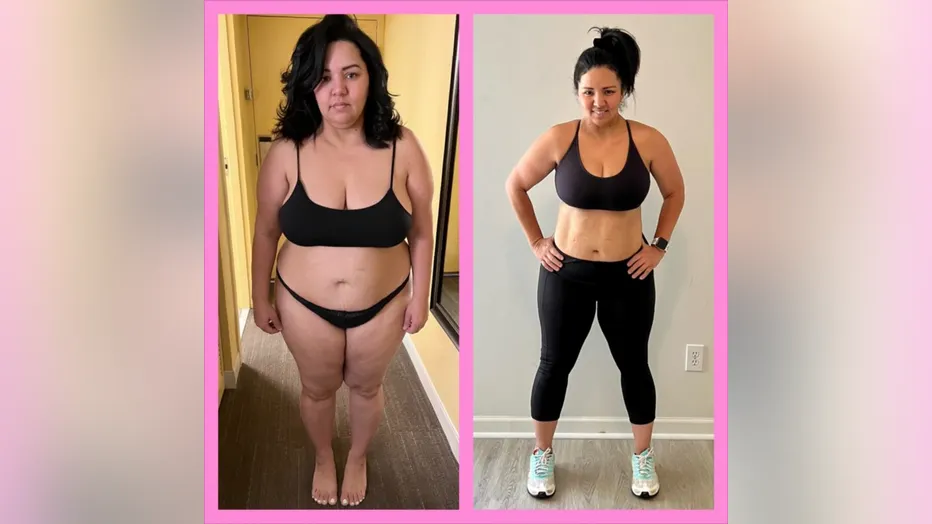 Rosie before and after Life After Weight-Loss Surgery