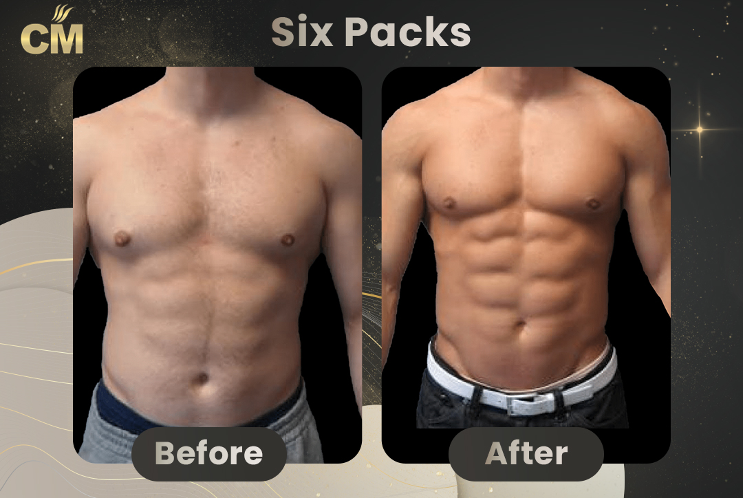 Six Packs Before After-1