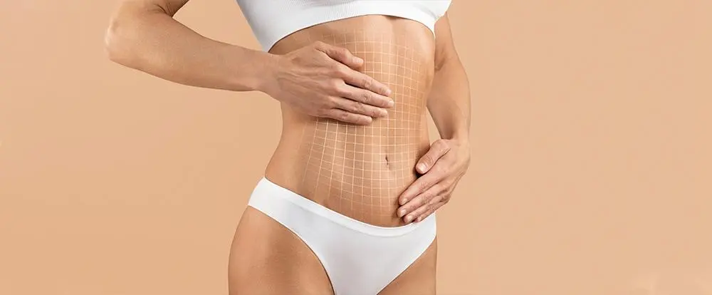 abdominoplasty-tummy-clinmedica