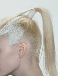 Surgical illustration showing elevation of the malar fat pad and orbicularis oculi muscle during a ponytail facelift procedure, emphasizing deep tissue repositioning for a youthful midface and lateral eye lift