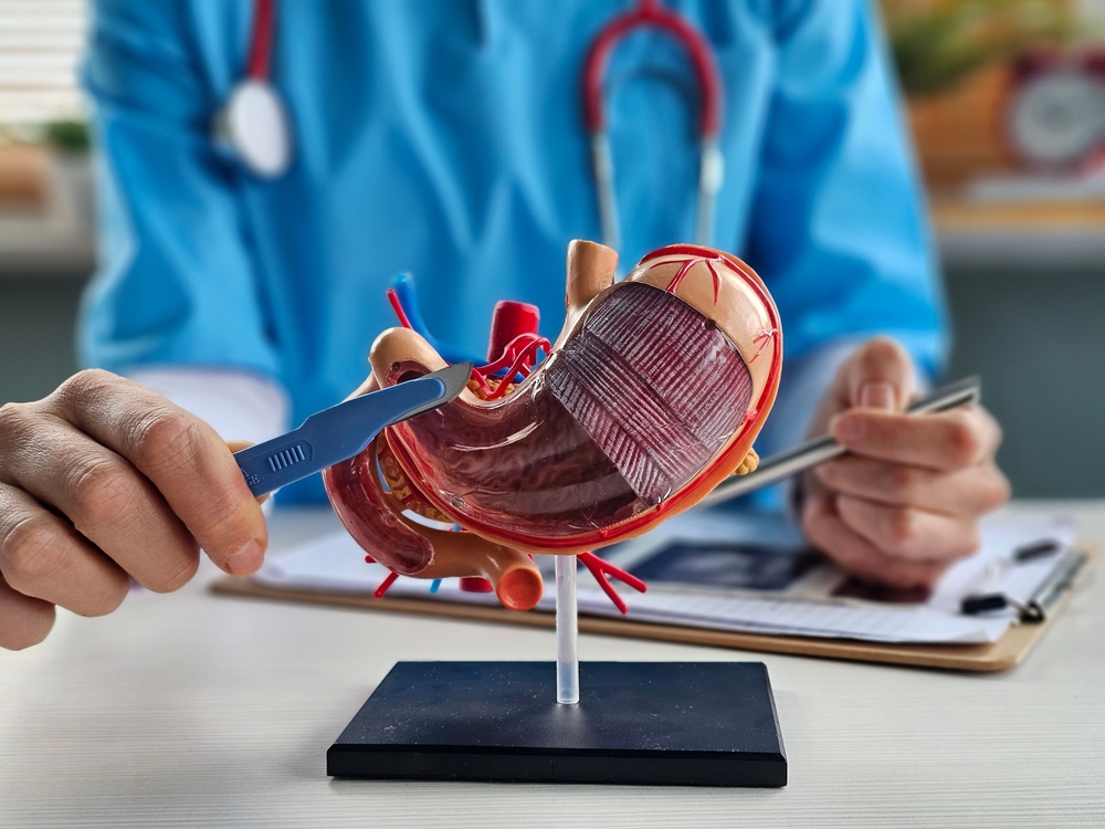 Gastric Sleeve in Turkey