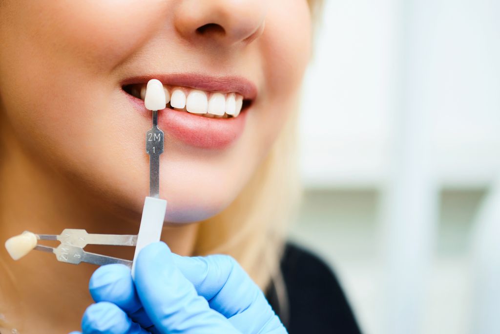 Dental Veneers In Turkey