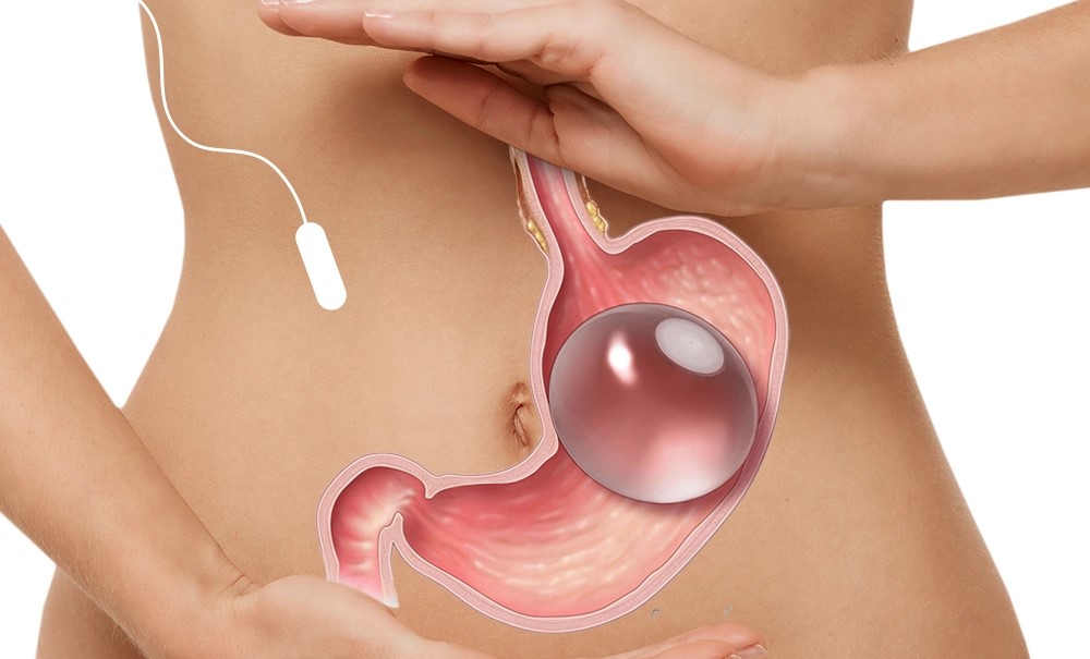 Gastric Balloon in Turkey