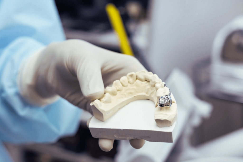 Dental and Tooth Crowns in Turkey