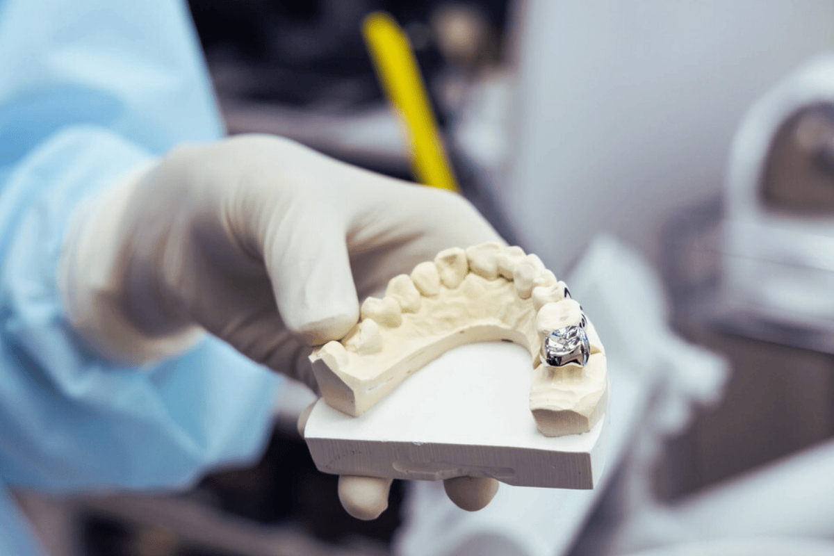 Dental and Tooth Crowns in Turkey