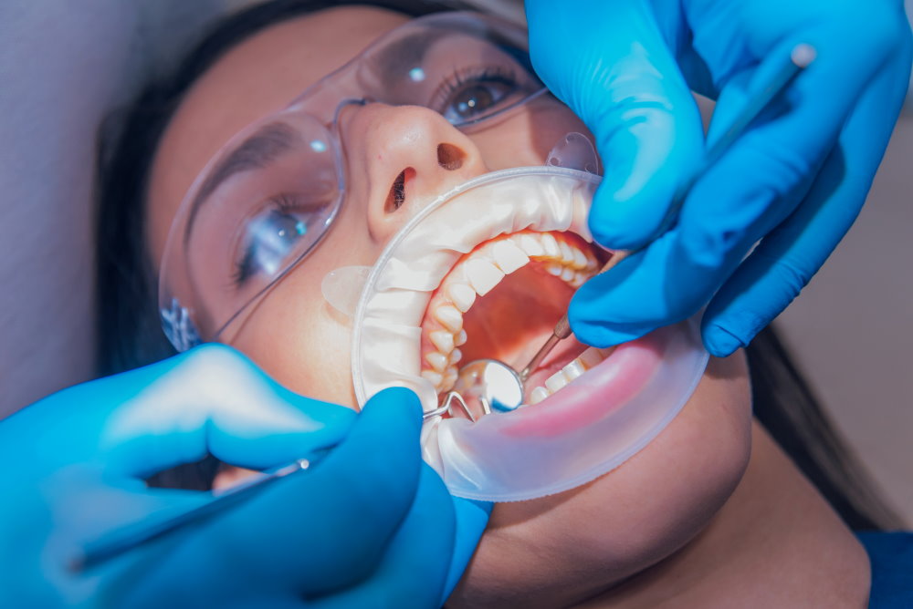 Dental Treatment In Turkey