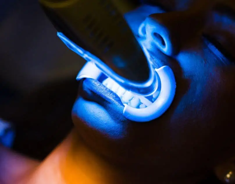 Teeth Whitening In Turkey